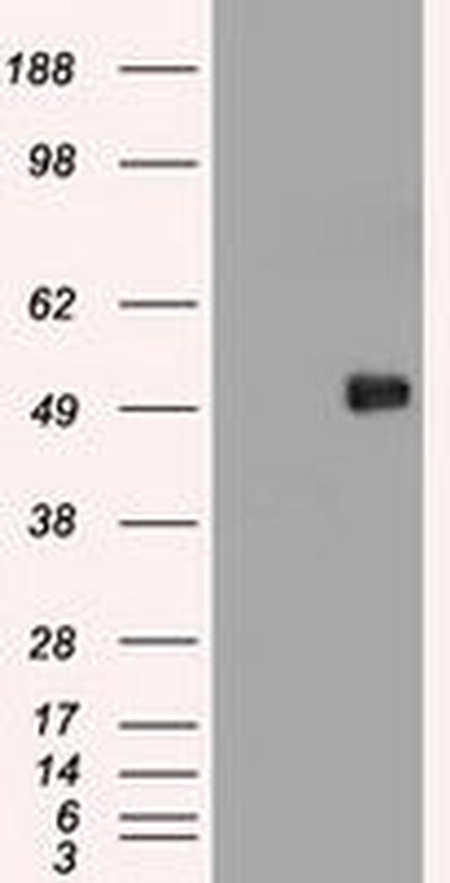 c-Myc Antibody in Western Blot (WB)