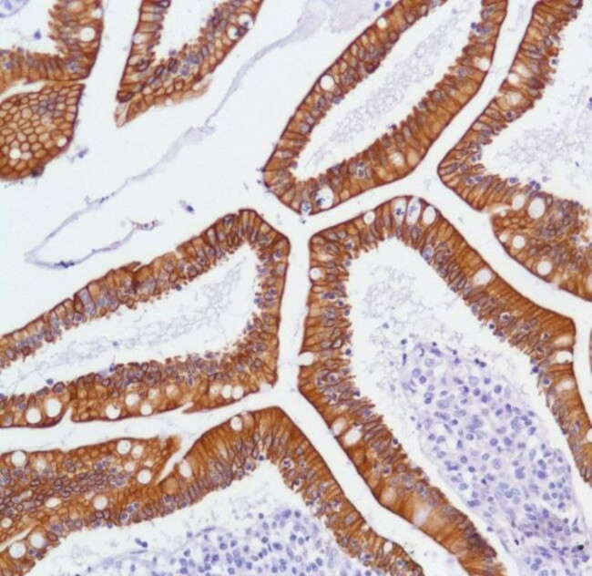 ErbB3 Antibody in Immunohistochemistry (Paraffin) (IHC (P))