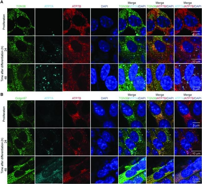 TGN46 Antibody in Immunocytochemistry (ICC/IF)