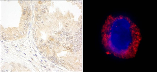 cAbl Antibody in Immunohistochemistry (IHC)