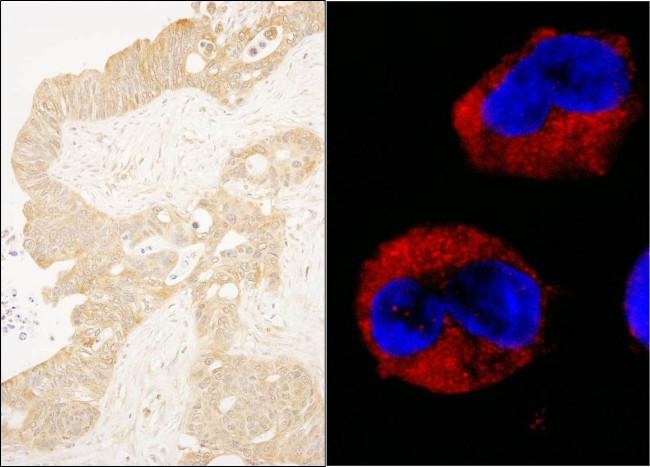 cAbl Antibody in Immunohistochemistry (IHC)