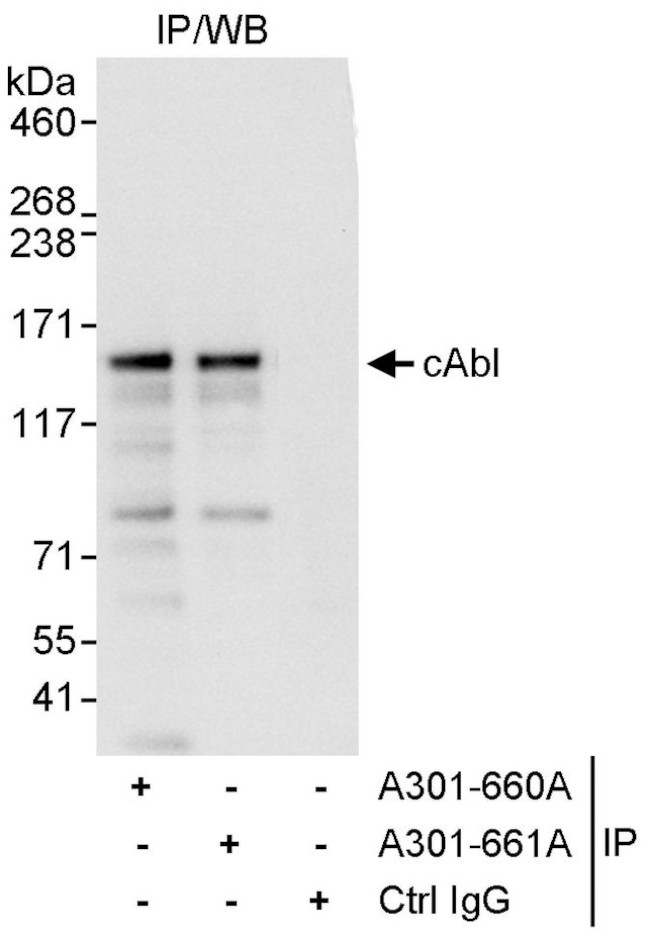 cAbl Antibody in Immunoprecipitation (IP)