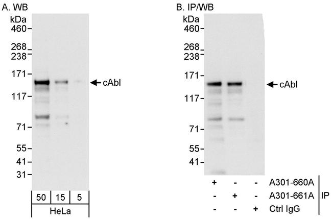 cAbl Antibody in Western Blot (WB)