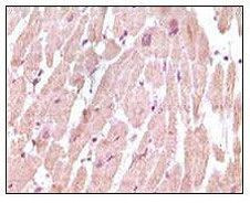 Cardiac Troponin I Antibody in Immunohistochemistry (Paraffin) (IHC (P))