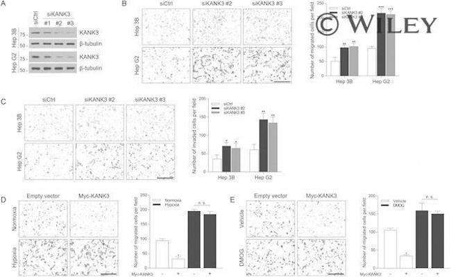 KANK3 Antibody in Western Blot (WB)