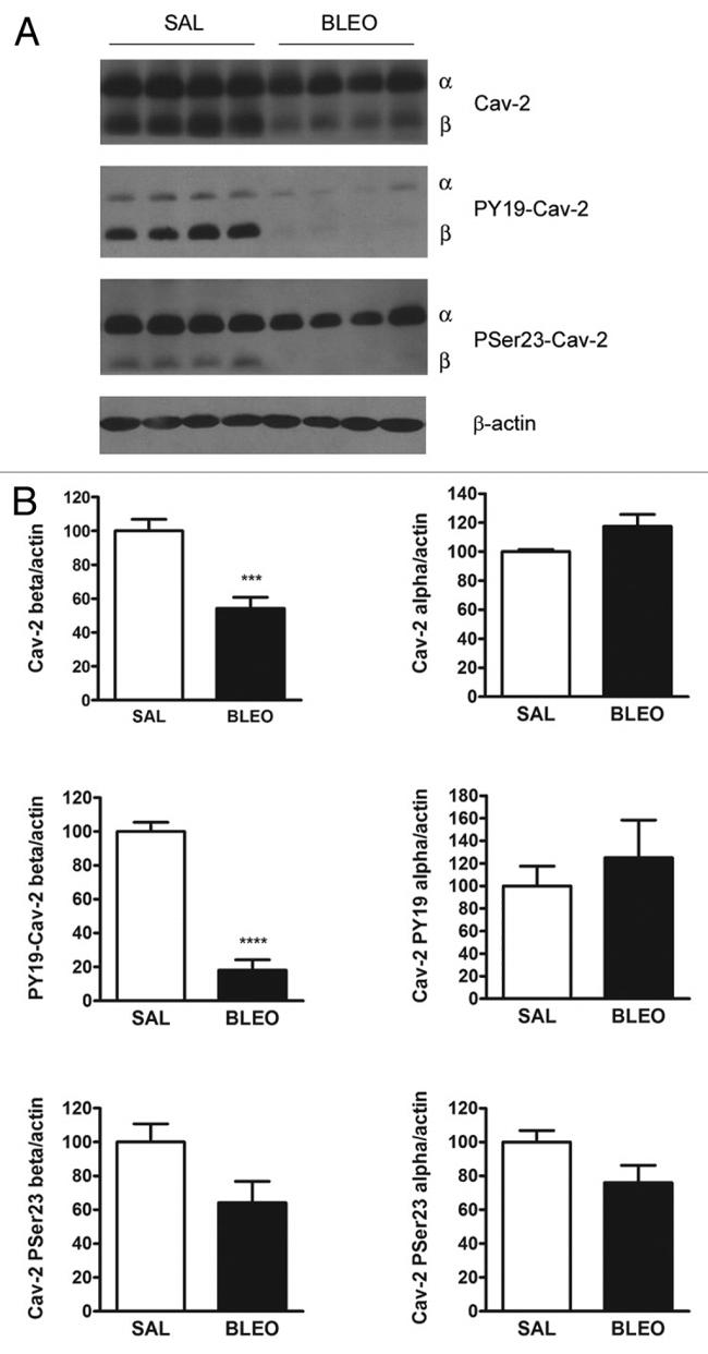 Phospho-Caveolin 2 (Tyr19) Antibody in Western Blot (WB)