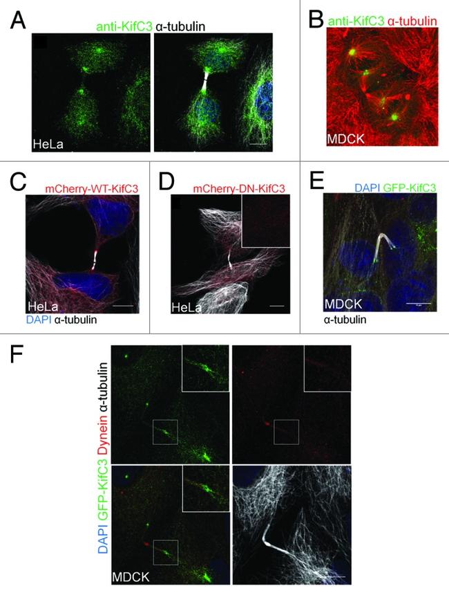 KIFC3 Antibody in Immunocytochemistry (ICC/IF)