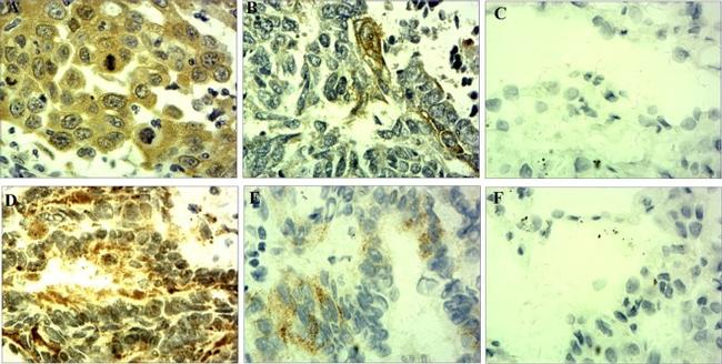 KLF6 Antibody in Immunohistochemistry (IHC)