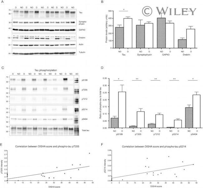 Phospho-Tau (Ser214) Antibody in Western Blot (WB)