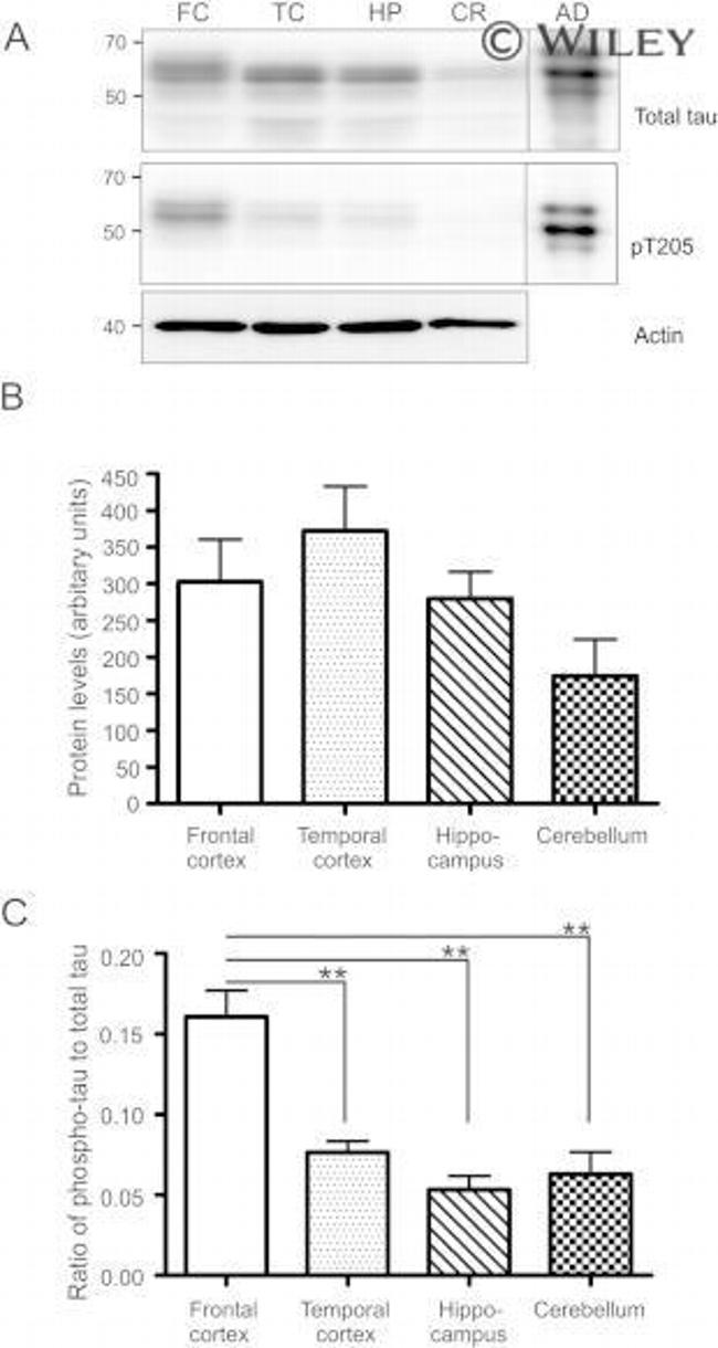 Phospho-Tau (Thr205) Antibody in Western Blot (WB)