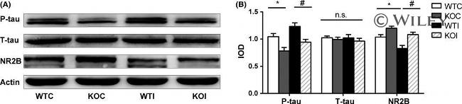 Phospho-Tau (Ser262) Antibody in Western Blot (WB)