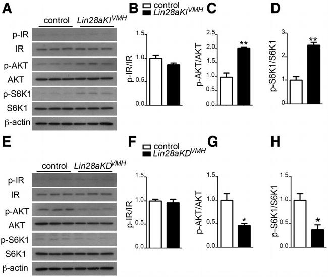 Phospho-INSR (Tyr972) Antibody in Western Blot (WB)