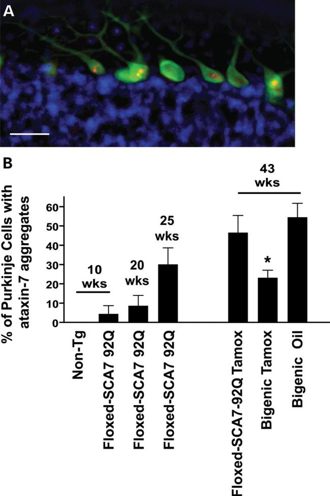 Ataxin 7 Antibody in Immunohistochemistry (IHC)