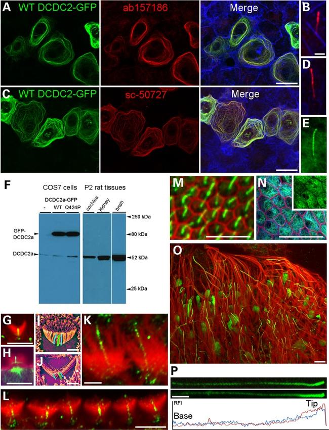 Acetyl-alpha Tubulin (Lys40) Antibody in Immunohistochemistry (IHC)