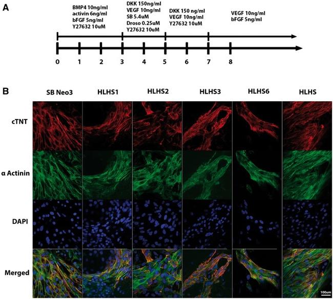 Sarcomeric alpha Actinin Antibody in Immunocytochemistry (ICC/IF)