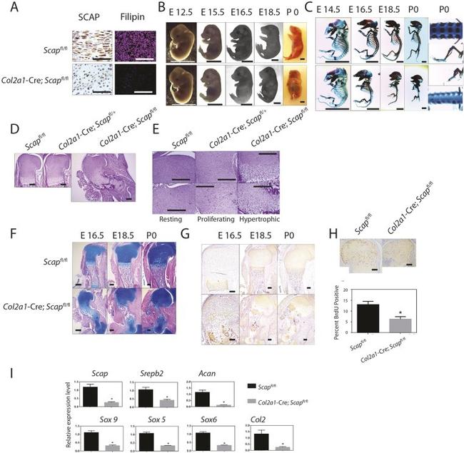 SCAP Antibody in Immunohistochemistry (IHC)