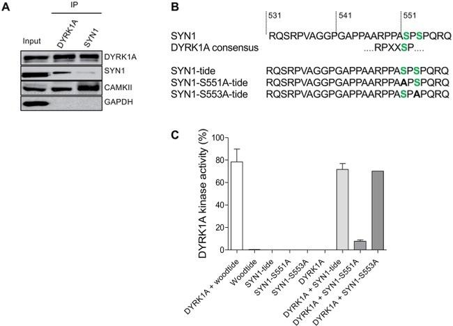 CaMKII alpha Antibody in Western Blot, Immunoprecipitation (WB, IP)