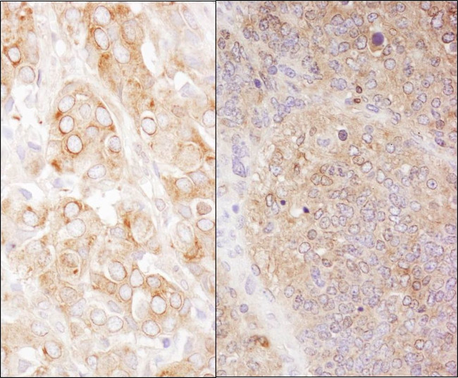 eEF2 Antibody in Immunohistochemistry (IHC)