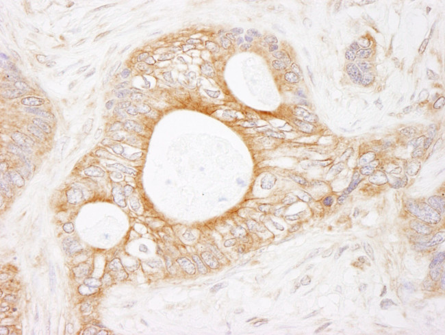 eEF2 Kinase Antibody in Immunohistochemistry (IHC)