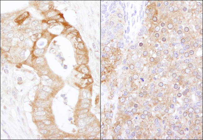 eEF2 Kinase Antibody in Immunohistochemistry (IHC)