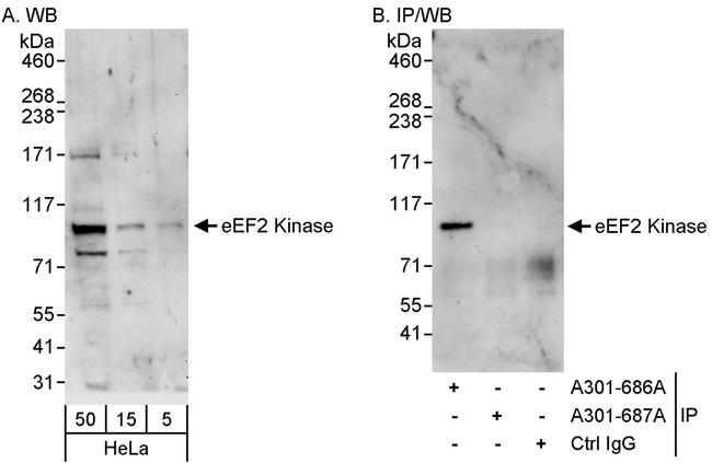 eEF2 Kinase Antibody in Western Blot (WB)