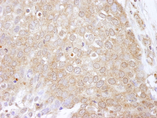 eEF2 Kinase Antibody in Immunohistochemistry (IHC)