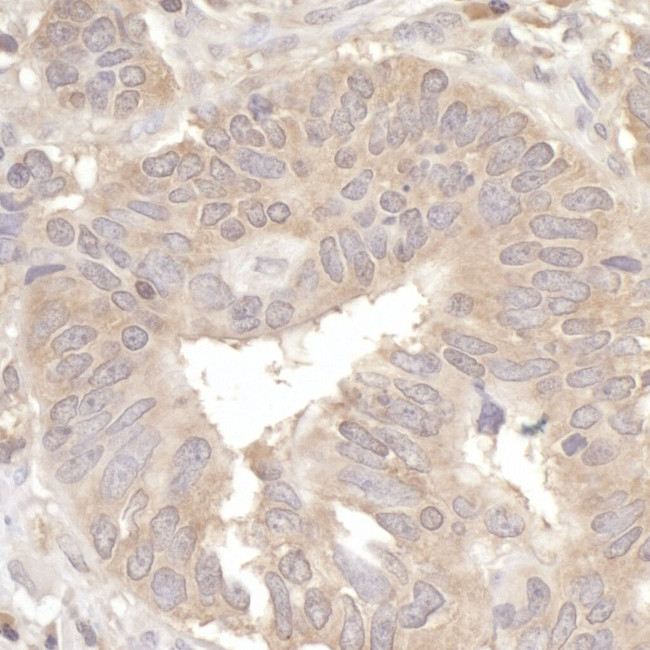 eIF2A Antibody in Immunohistochemistry (IHC)