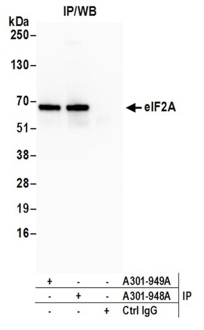 eIF2A Antibody in Immunoprecipitation (IP)