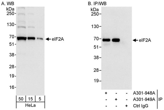 eIF2A Antibody in Western Blot (WB)