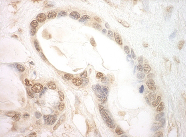 eIF2B5 Antibody in Immunohistochemistry (IHC)