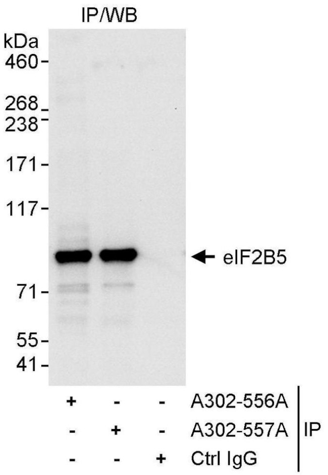 eIF2B5 Antibody in Immunoprecipitation (IP)