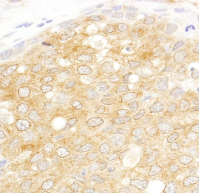 eIF2beta/EIF2S2 Antibody in Immunohistochemistry (IHC)