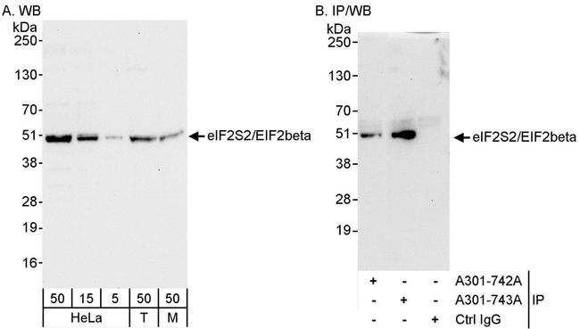 eIF2beta/EIF2S2 Antibody in Western Blot (WB)