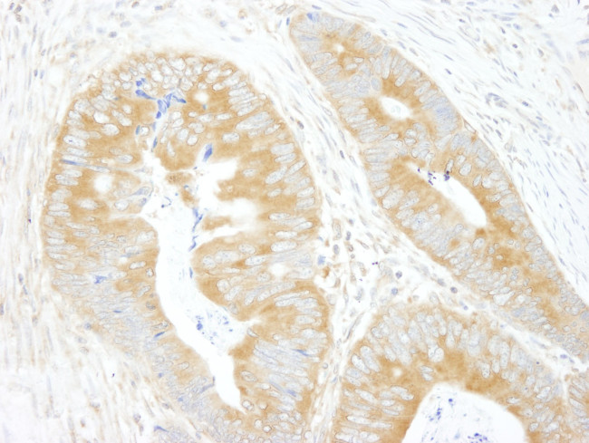 eIF3A/eIF3S10 Antibody in Immunohistochemistry (IHC)