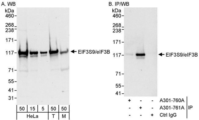 eIF3B/EIF3S9 Antibody in Western Blot (WB)