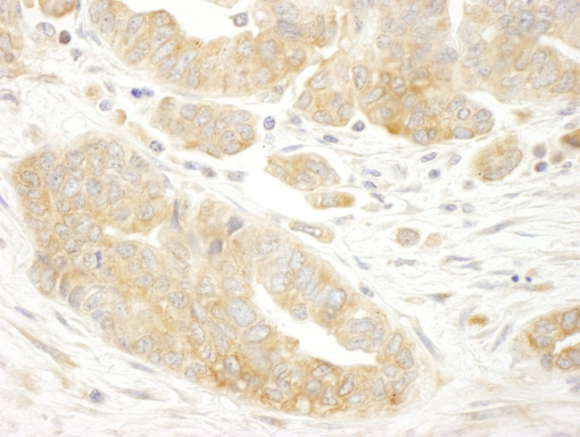 eIF3B/EIF3S9 Antibody in Immunohistochemistry (IHC)