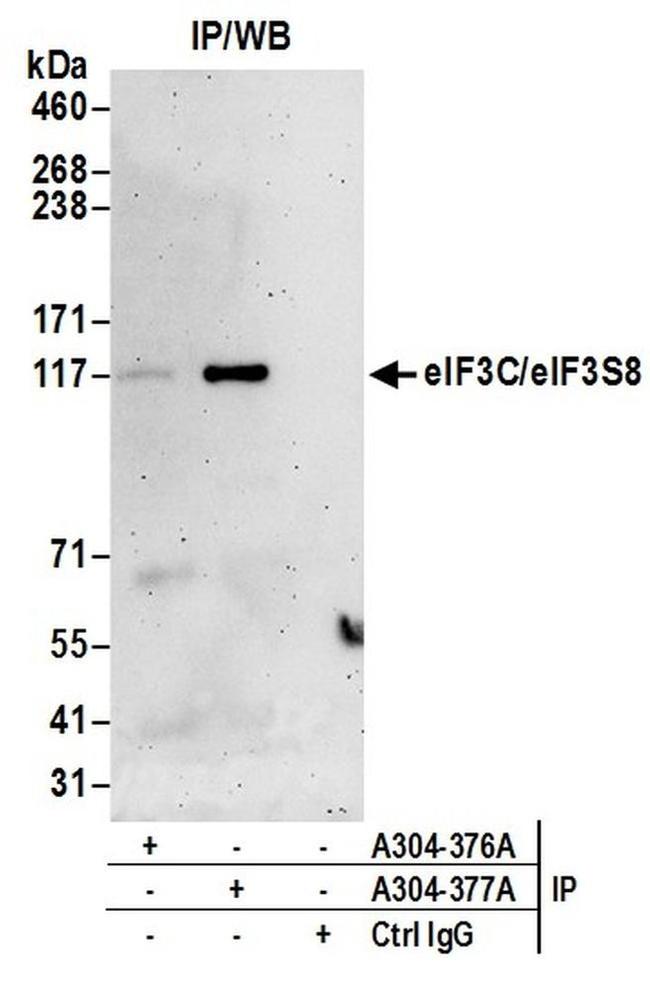 eIF3C/eIF3S8 Antibody in Western Blot (WB)