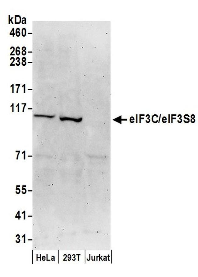 eIF3C/eIF3S8 Antibody in Western Blot (WB)