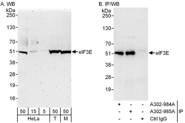 eIF3E Antibody in Western Blot (WB)