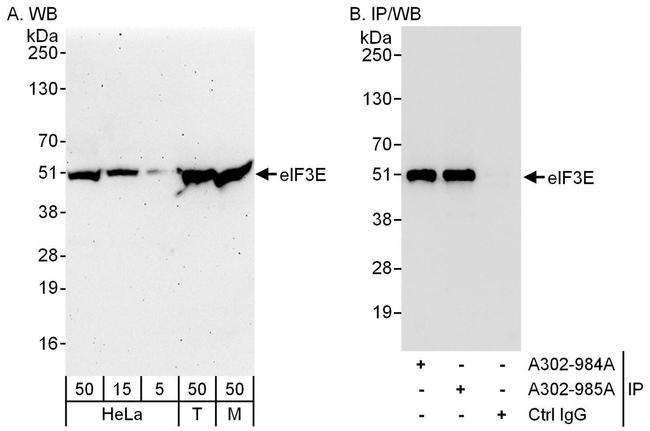 eIF3E Antibody in Western Blot (WB)