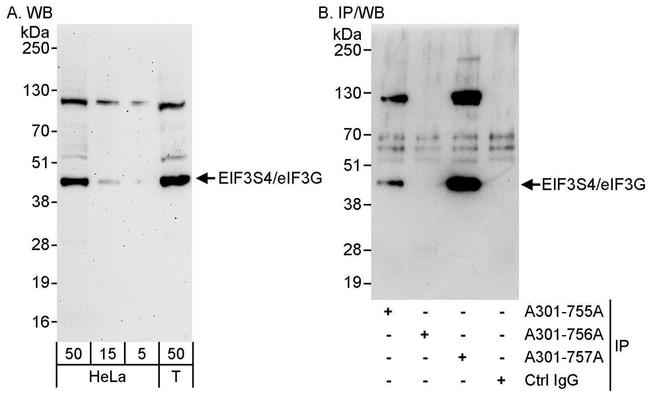 eIF3G/EIF3S4 Antibody in Western Blot (WB)