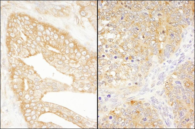 eIF3J/EIF3S1 Antibody in Immunohistochemistry (IHC)