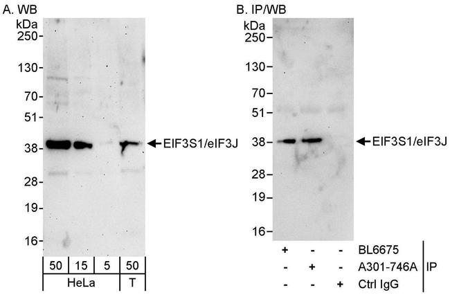 eIF3J/EIF3S1 Antibody in Western Blot (WB)