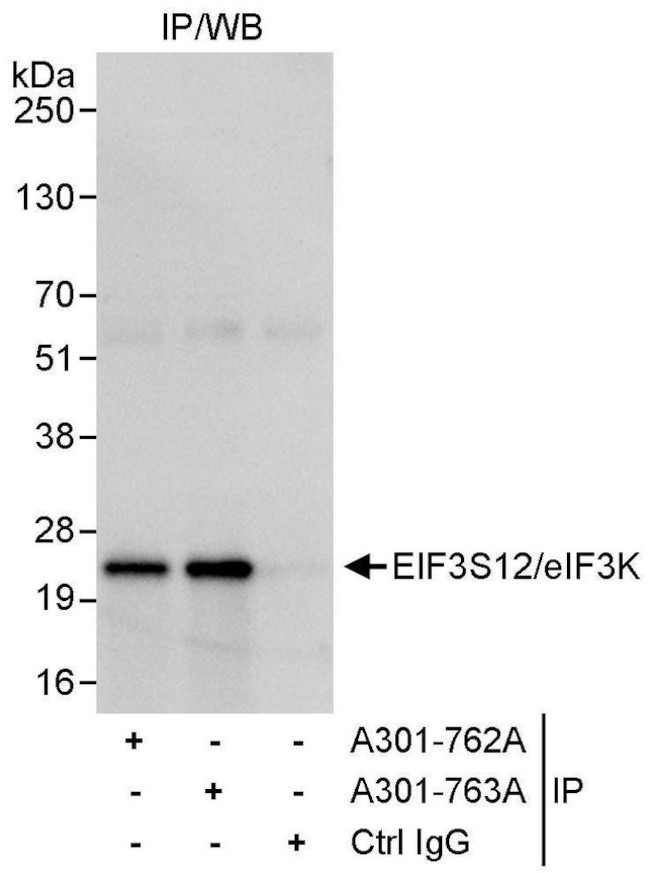 eIF3K/EIF3S12 Antibody in Immunoprecipitation (IP)