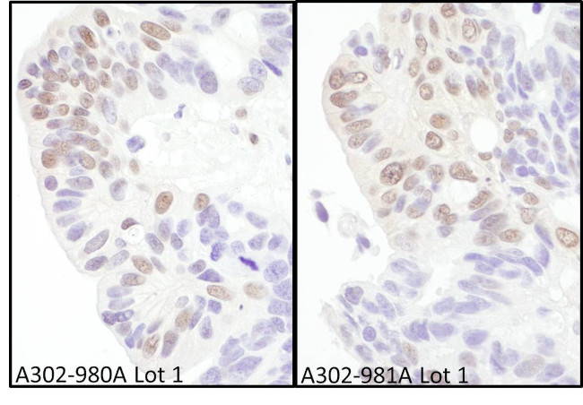 eIF4AIII/EIF4A3 Antibody in Immunohistochemistry (IHC)
