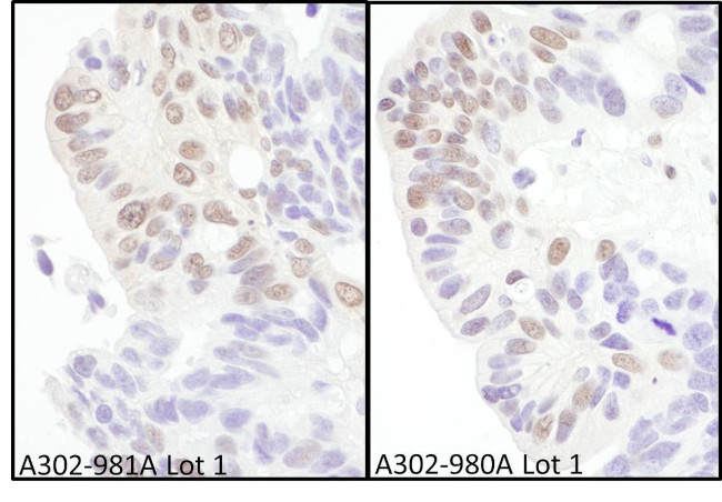 eIF4AIII/EIF4A3 Antibody in Immunohistochemistry (IHC)