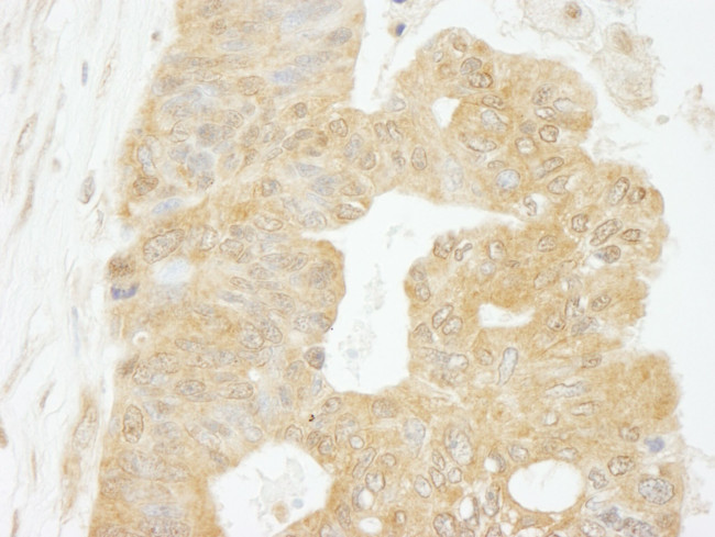 eIF4G1/eIF4GI Antibody in Immunohistochemistry (IHC)