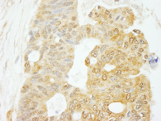 eIF4G1/eIF4GI Antibody in Immunohistochemistry (IHC)