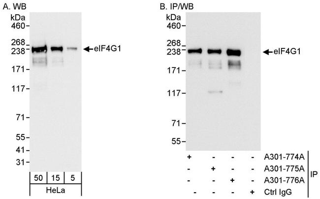 eIF4G1/eIF4GI Antibody in Western Blot (WB)