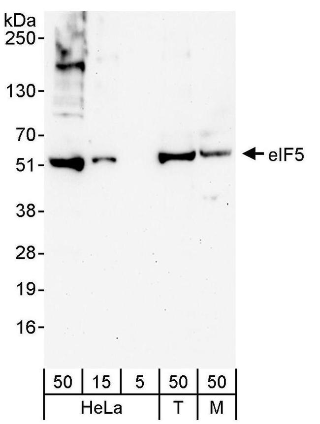 eIF5 Antibody in Western Blot (WB)